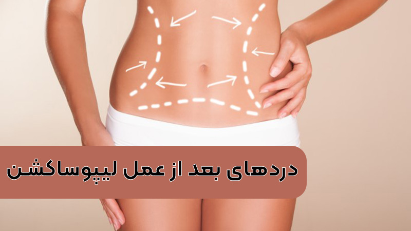 آیا لیپوماتیک بازو درد دارد+آیا لیپوماتیک ران درد دارد+بعد از اسلیو معده دوباره چاق می‌شویم+چرا بعد از عمل ابدومینوپلاستی باید گن پوشید