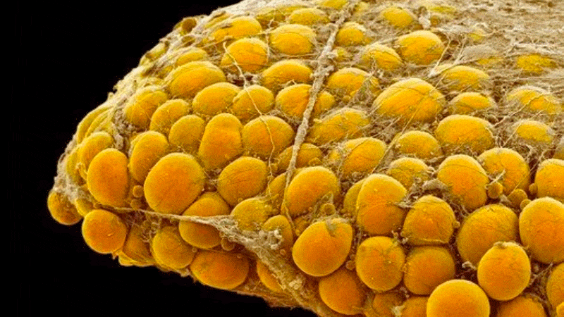 سلول بنیادی چربی